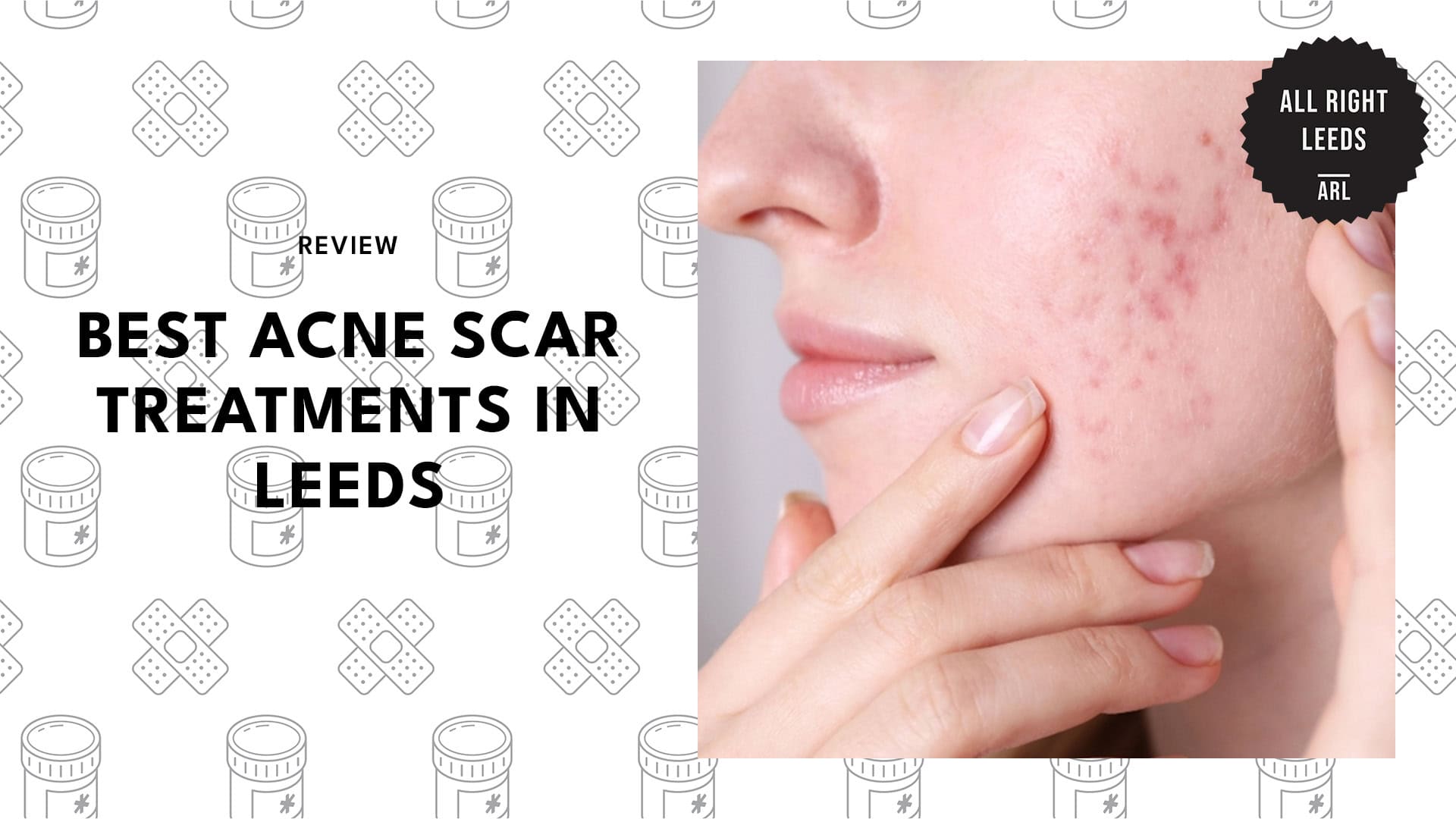 acne-scar-treatments-in-leeds